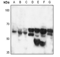 CD120b Rabbit Polyclonal Antibody