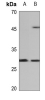 cTnI Rabbit Polyclonal Antibody