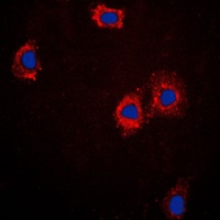 cTnI Rabbit Polyclonal Antibody