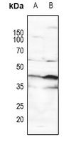 p53 (Phospho-S15) Rabbit Polyclonal Antibody