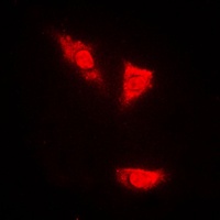 p53 (Phospho-S15) Rabbit Polyclonal Antibody