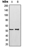 p53 (Phospho-S315) Rabbit Polyclonal Antibody