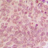 p53 (Phospho-S315) Rabbit Polyclonal Antibody