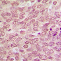 p53 Rabbit Polyclonal Antibody