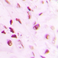 p73 (Phospho-Y99) Rabbit Polyclonal Antibody