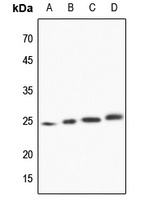 TCTP Rabbit Polyclonal Antibody