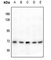 Tyrosinase Rabbit Polyclonal Antibody