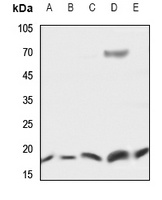 UBE2D2 Rabbit Polyclonal Antibody