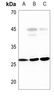 PGP9.5 Rabbit Polyclonal Antibody