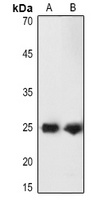 PGP9.5 Rabbit Polyclonal Antibody