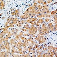 PGP9.5 Rabbit Polyclonal Antibody