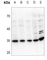 UDG Rabbit Polyclonal Antibody