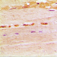 UDG Rabbit Polyclonal Antibody