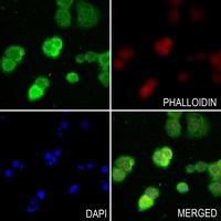 UDG Rabbit Polyclonal Antibody