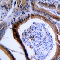 VASP Rabbit Polyclonal Antibody