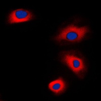 VASP Rabbit Polyclonal Antibody