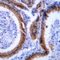 VASP Rabbit Polyclonal Antibody