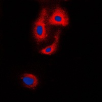 VASP Rabbit Polyclonal Antibody