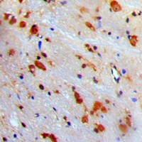 VCP Rabbit Polyclonal Antibody