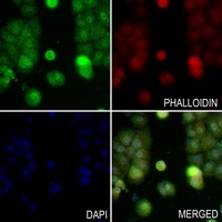 VCP Rabbit Polyclonal Antibody