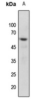 Vimentin (Phospho-S56) Rabbit Polyclonal Antibody