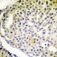 Vimentin (Phospho-S56) Rabbit Polyclonal Antibody