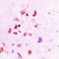 XRCC3 Rabbit Polyclonal Antibody