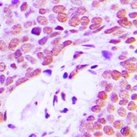 Ku80 Rabbit Polyclonal Antibody