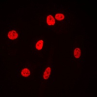 Ku80 Rabbit Polyclonal Antibody