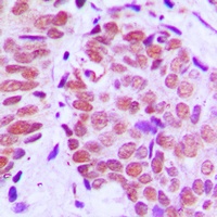 Ku80 Rabbit Polyclonal Antibody