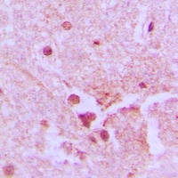 Ku80 Rabbit Polyclonal Antibody