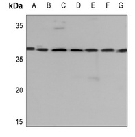 14-3-3 gamma Antibody [KO/KD Validated]
