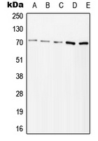 ZAP70 (Phospho-Y315) Rabbit Polyclonal Antibody