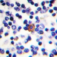 ZAP70 (Phospho-Y315) Rabbit Polyclonal Antibody