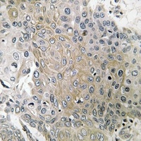 CD184 (Phospho-S339) Antibody