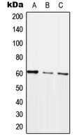 ARHGEF5 Antibody