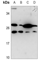 PSCA Rabbit Polyclonal Antibody