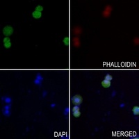 PSCA Rabbit Polyclonal Antibody