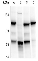 BRD3 Rabbit Polyclonal Antibody