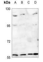 Adracalin Rabbit Polyclonal Antibody