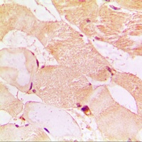 Dysferlin Rabbit Polyclonal Antibody