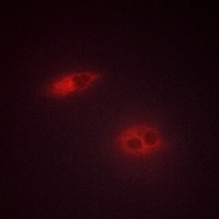 Dysferlin Rabbit Polyclonal Antibody