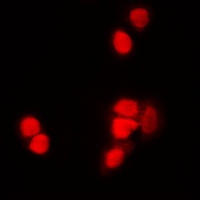 Histone H3 (Acetyl-K9) Antibody