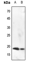 Histone H3 (Phospho-S10) Antibody