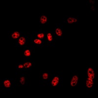 Cullin 2 Rabbit Polyclonal Antibody