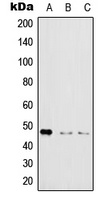 IKK gamma (Phospho-S31) Rabbit Polyclonal Antibody