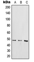 IKK gamma (Phospho-S85) Rabbit Polyclonal Antibody