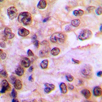 IKK gamma (Phospho-S85) Rabbit Polyclonal Antibody