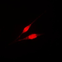 IKK gamma Rabbit Polyclonal Antibody