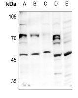 HAT1 Rabbit Polyclonal Antibody